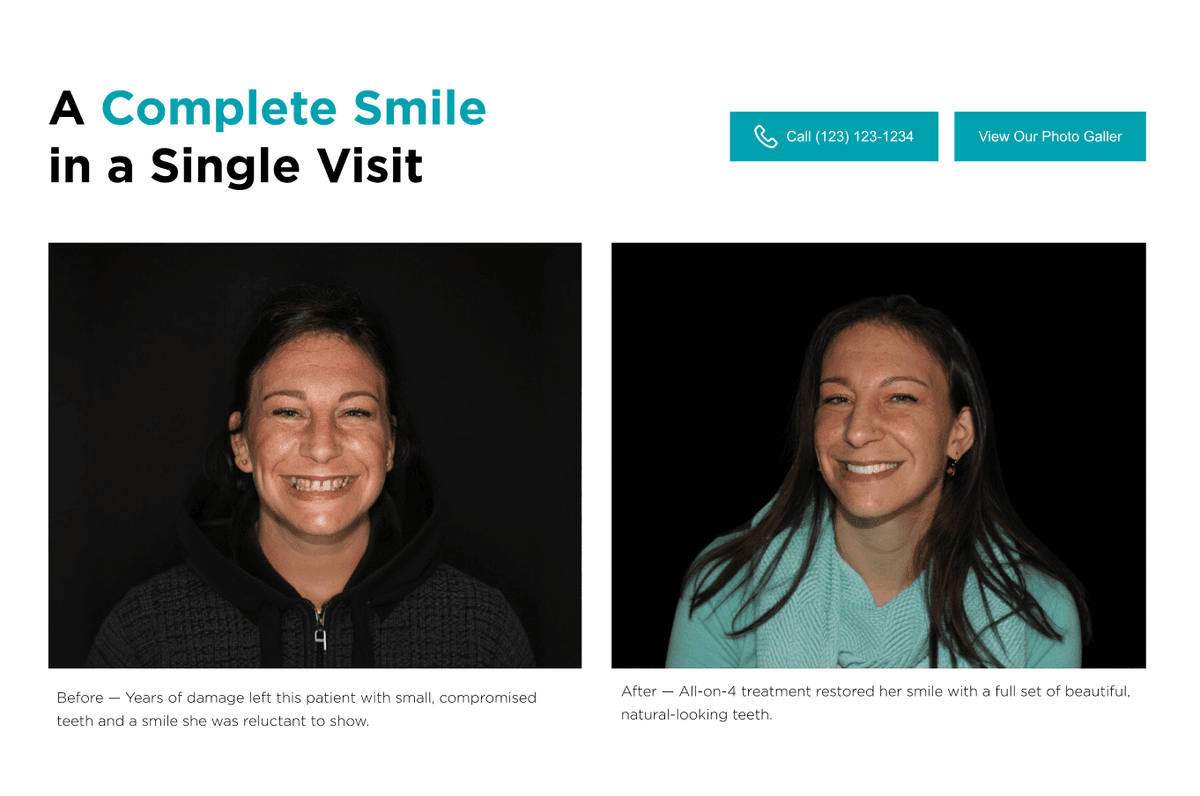 Before and after smile transformation